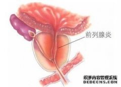 龙岩前列腺炎哪里治疗好啊